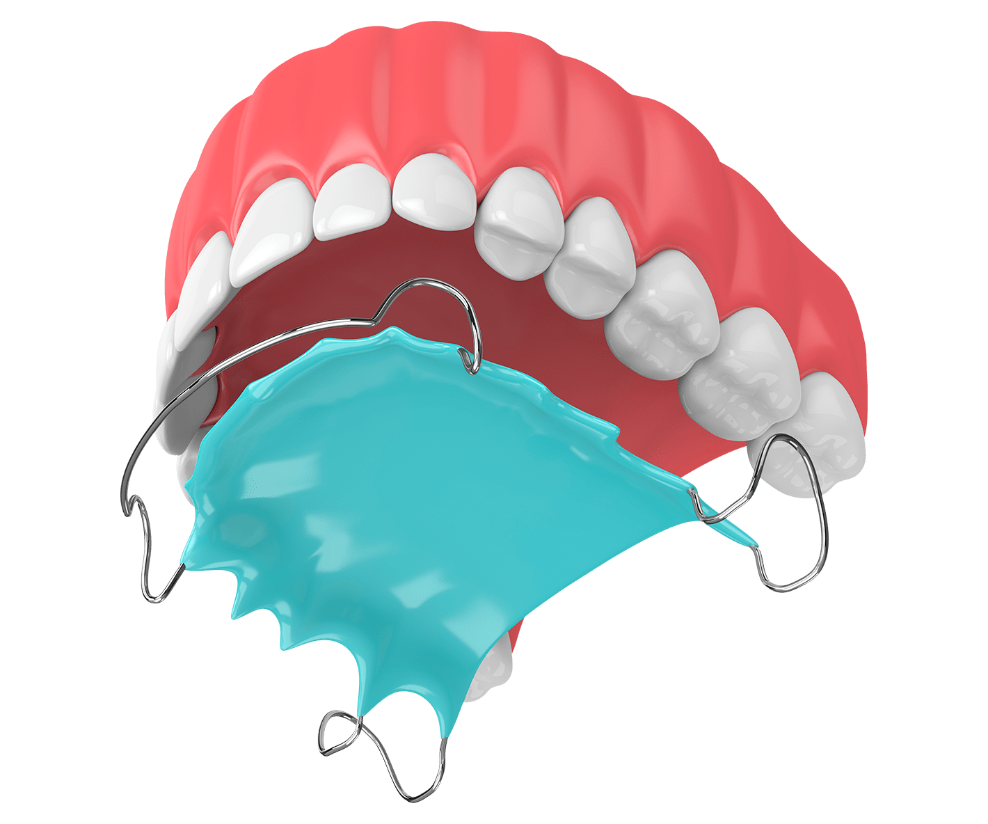 Ортодонтичні пластини