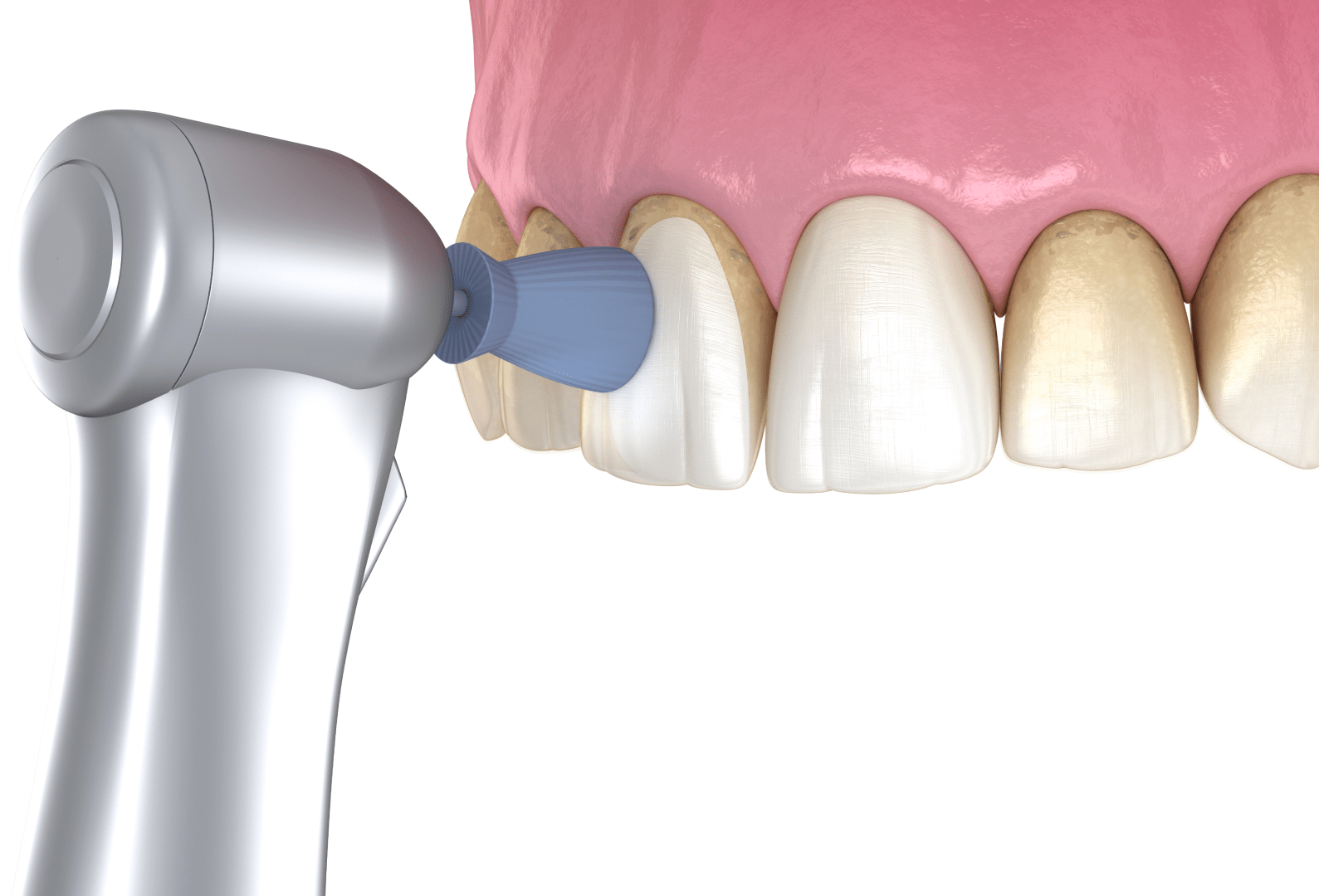 Чистка зубов