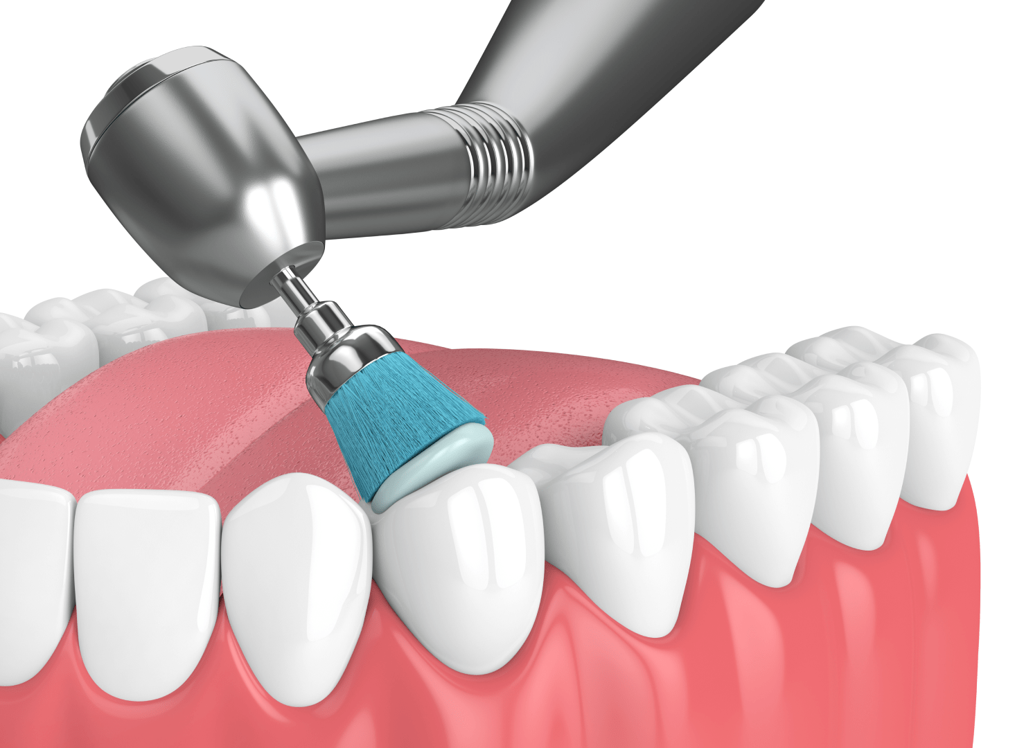 Механическая чистка зубов