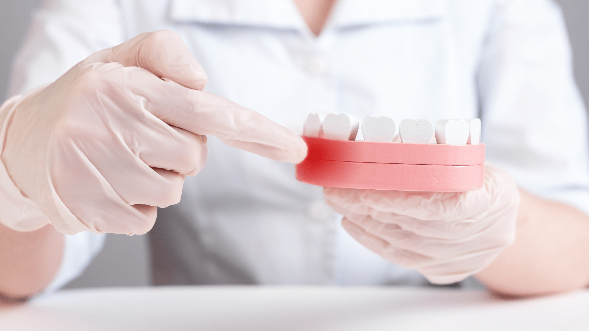 Флюс на яснах у дитини