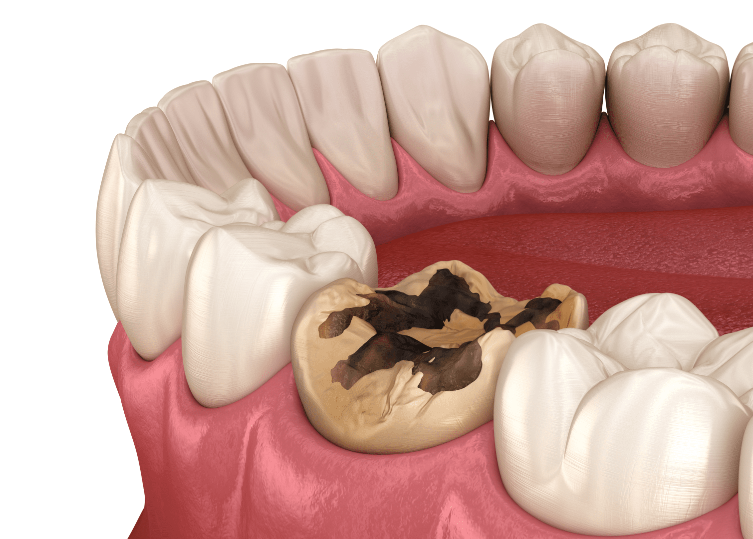 Діагностика зубів