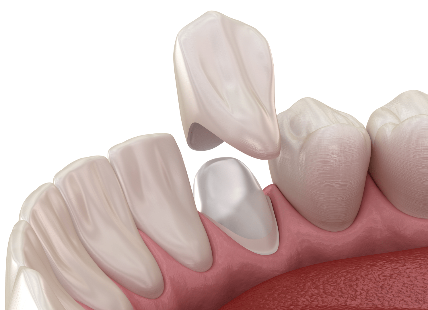 Альтернативні варіанти