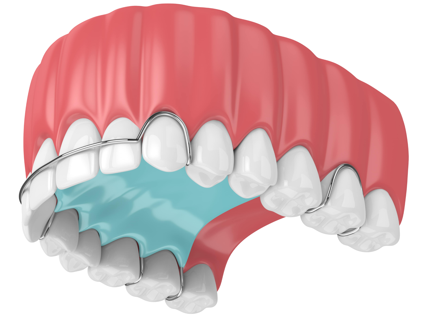 Ортодонтична пластина