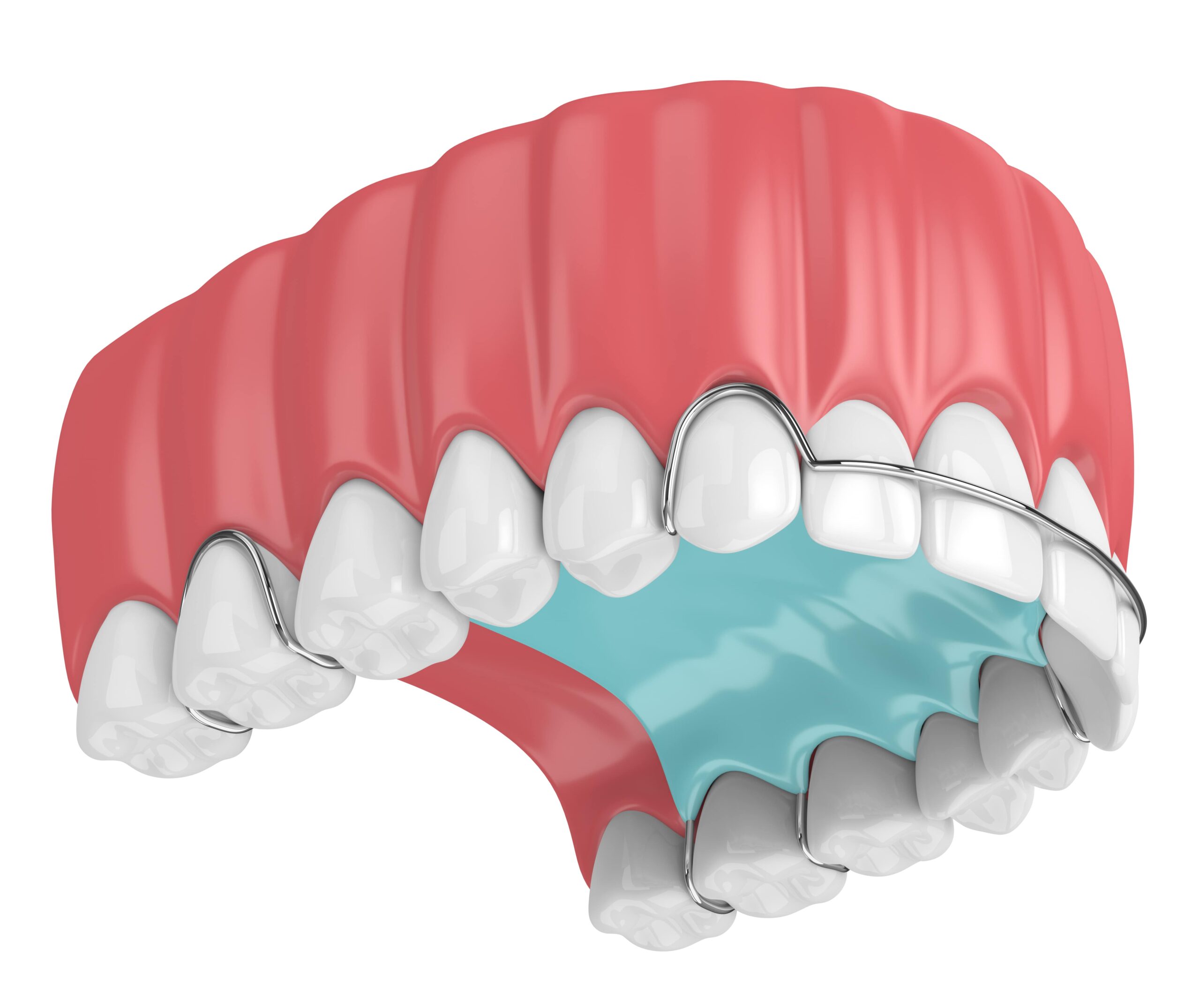Встановлення протезу