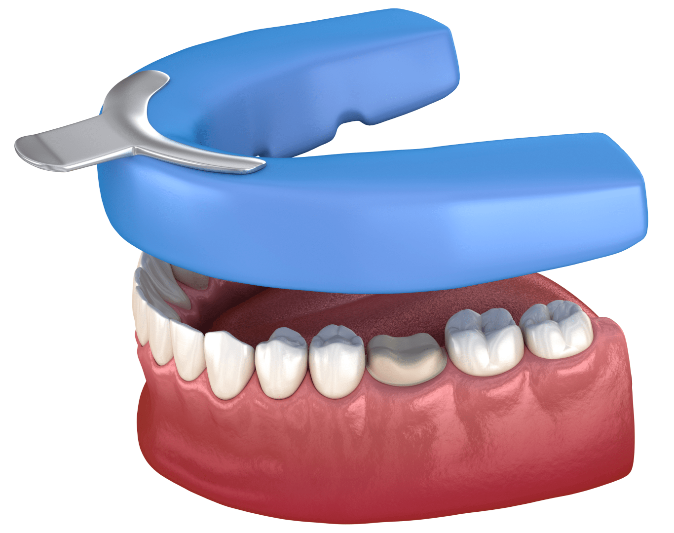 Зняття зліпка