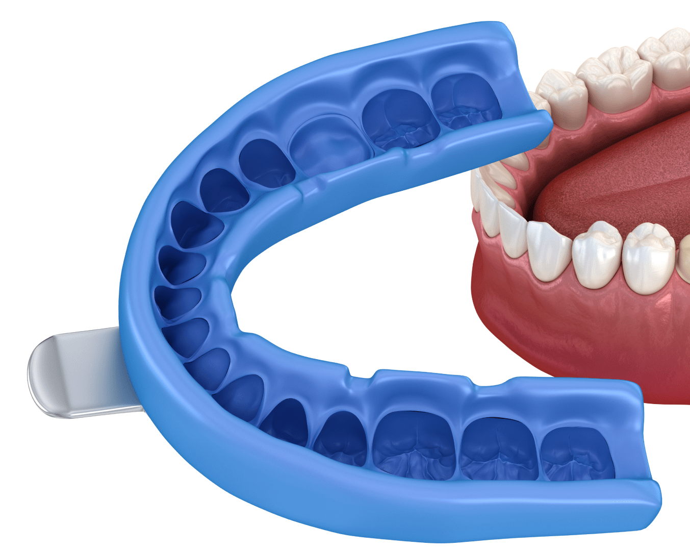 Зняття відбитків та виготовлення