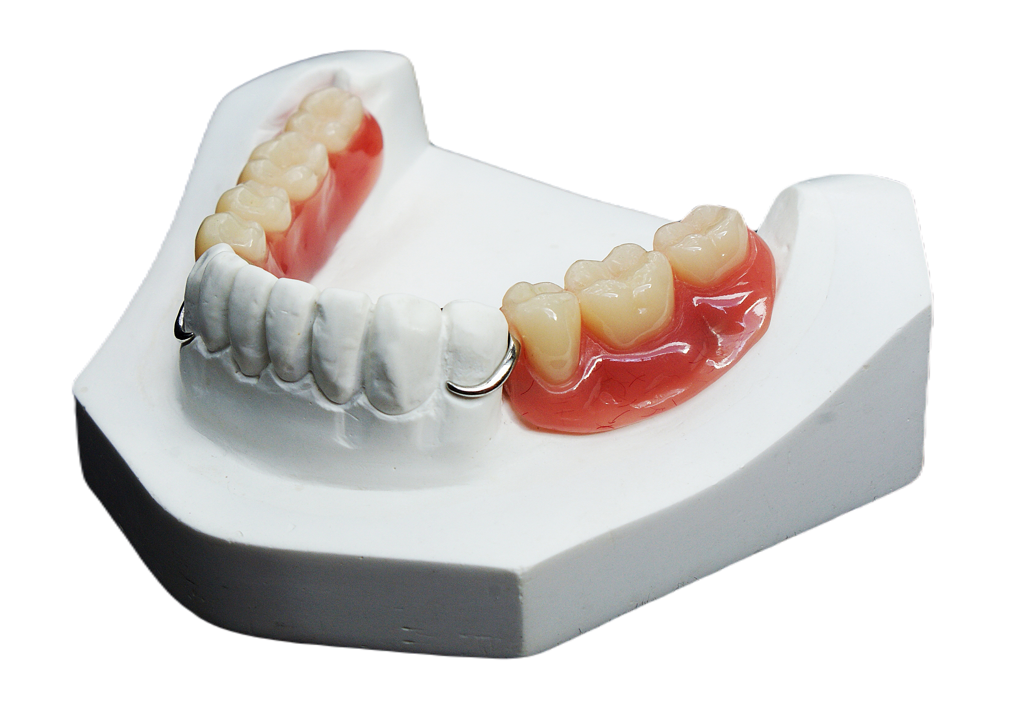 Зубне протезування