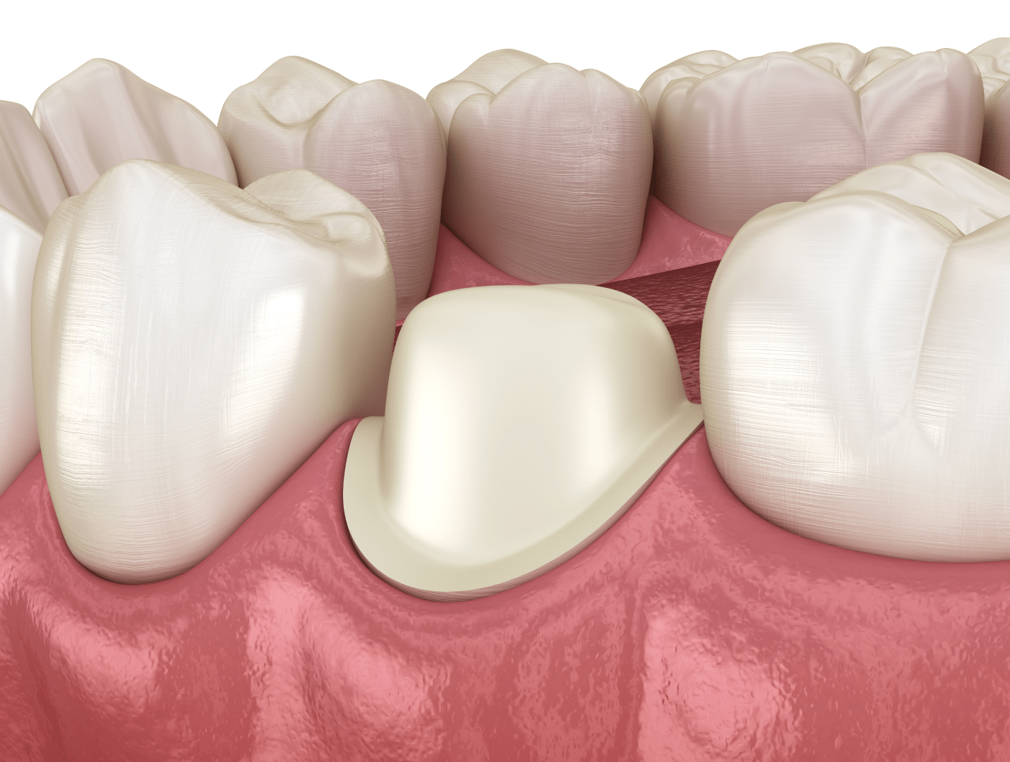 Зняття відбитку