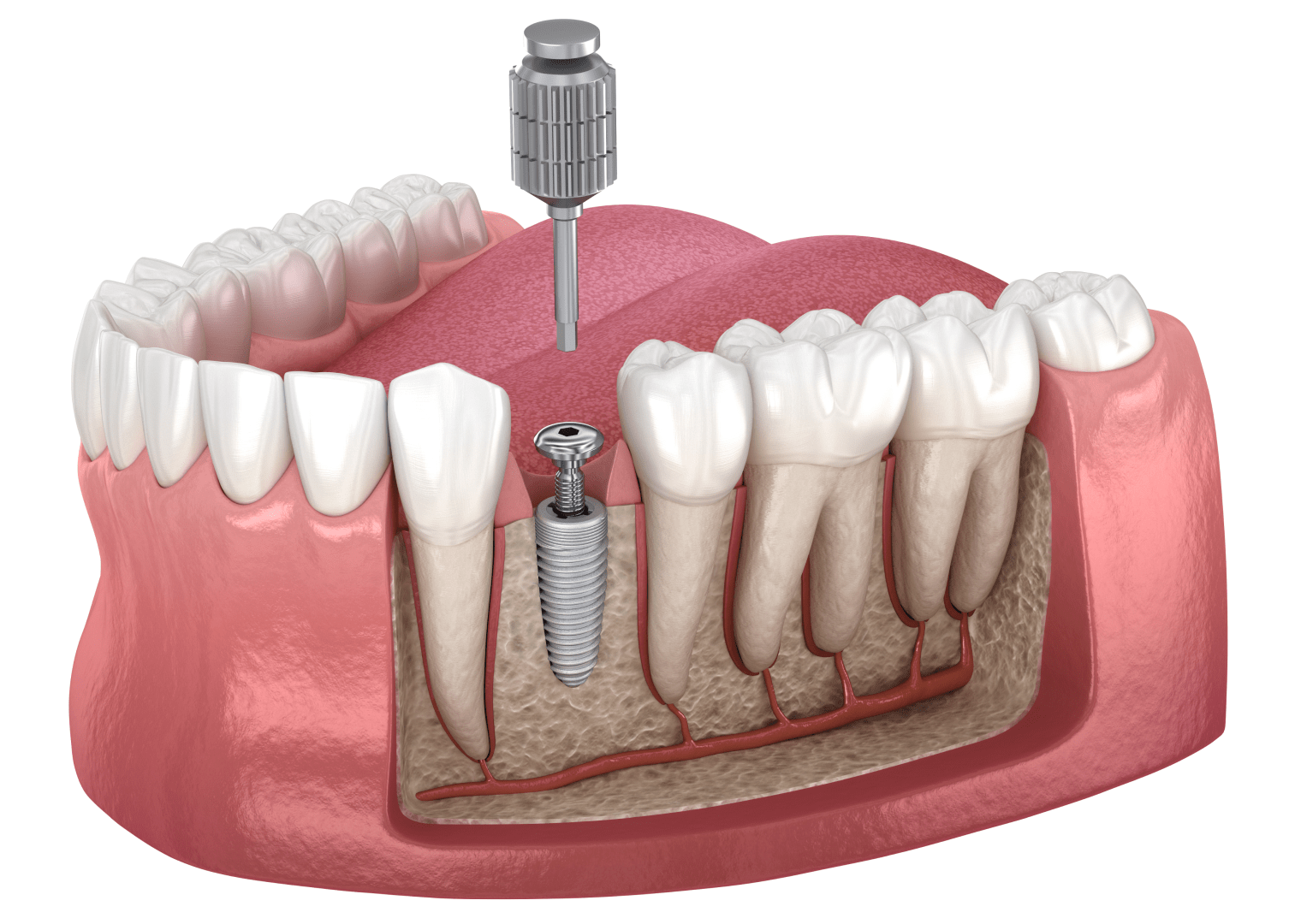 післяопераційна реабілітація