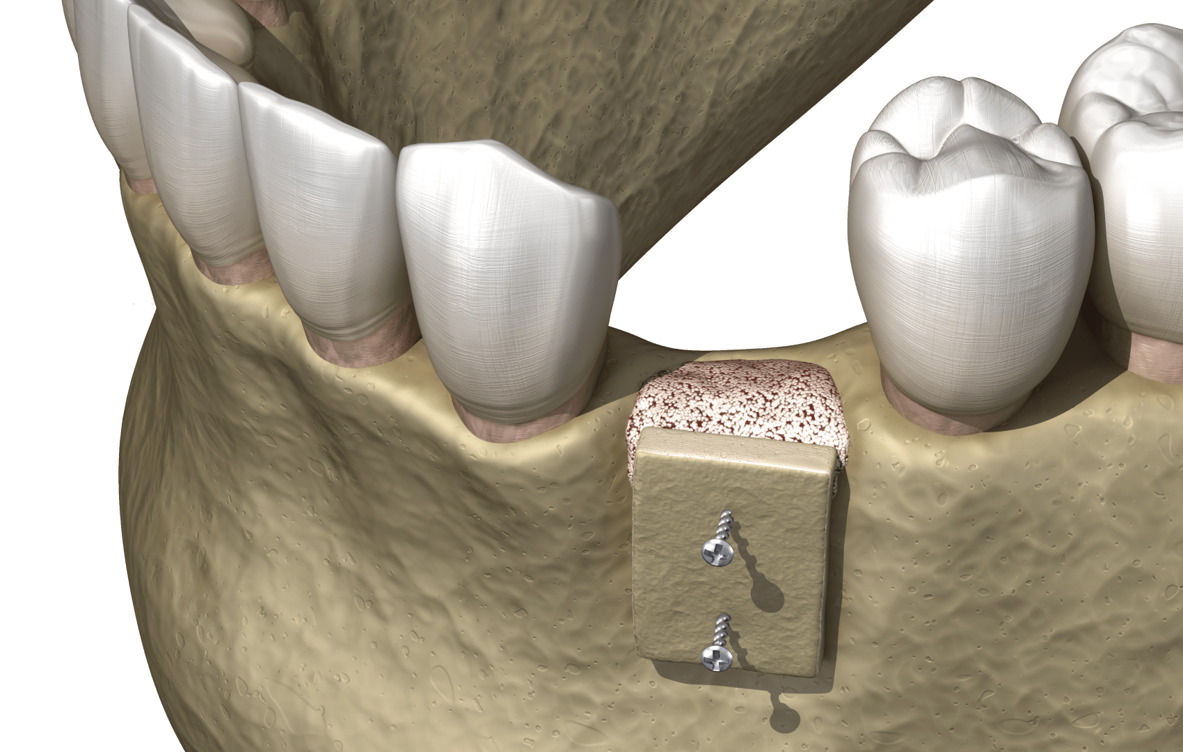 підготовка