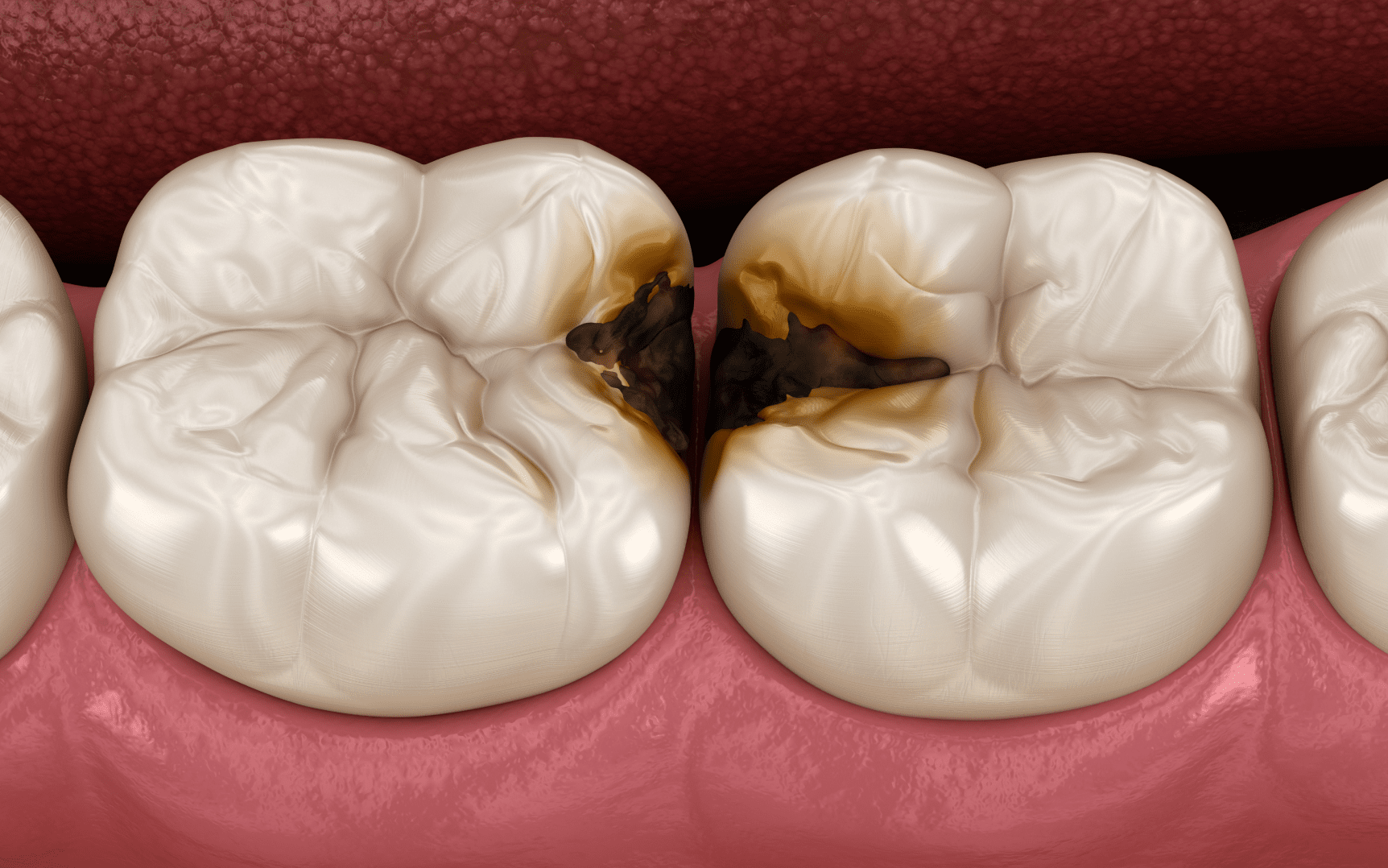 Огляд та діагностика зубів