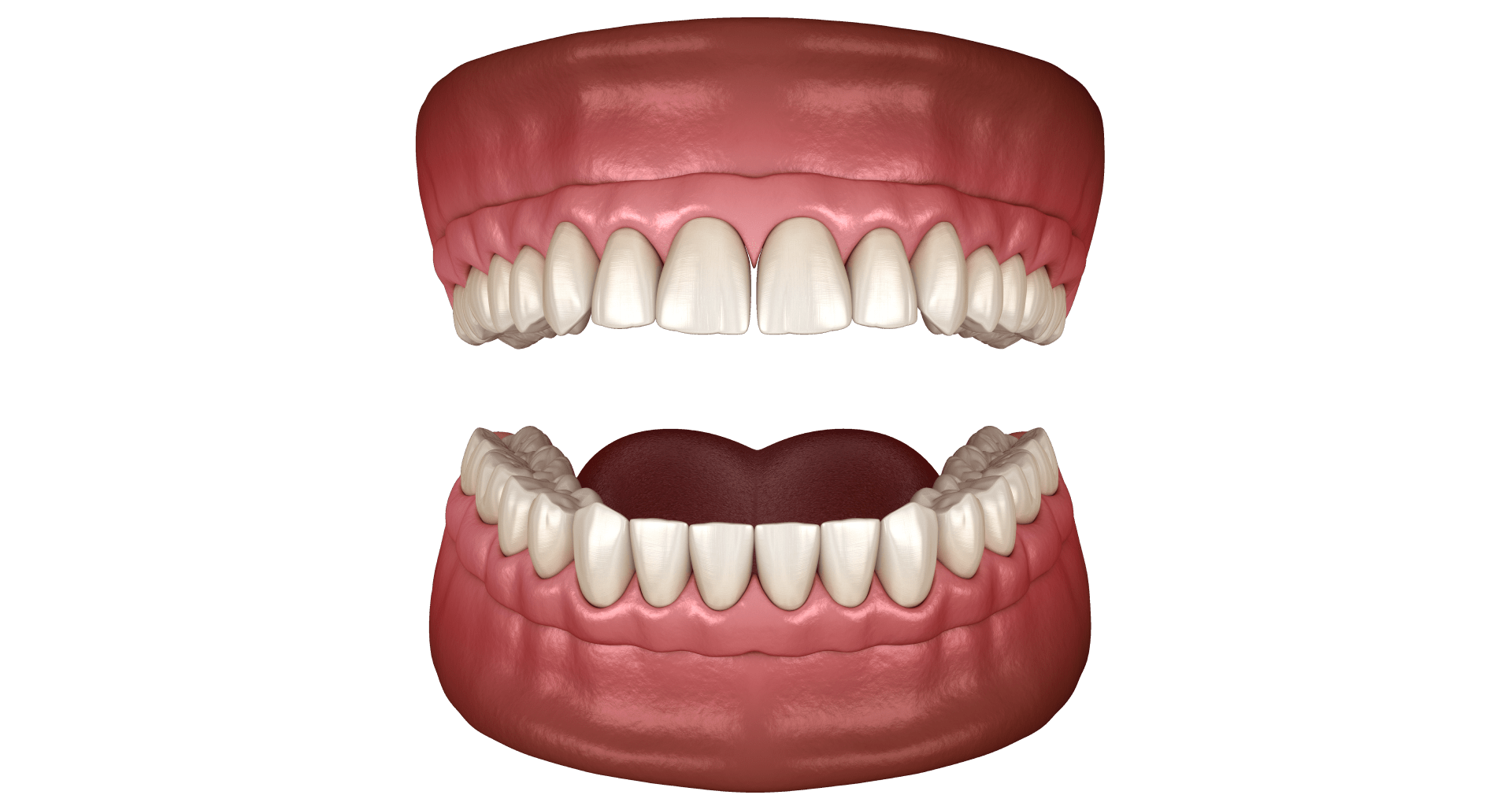 Підготовка