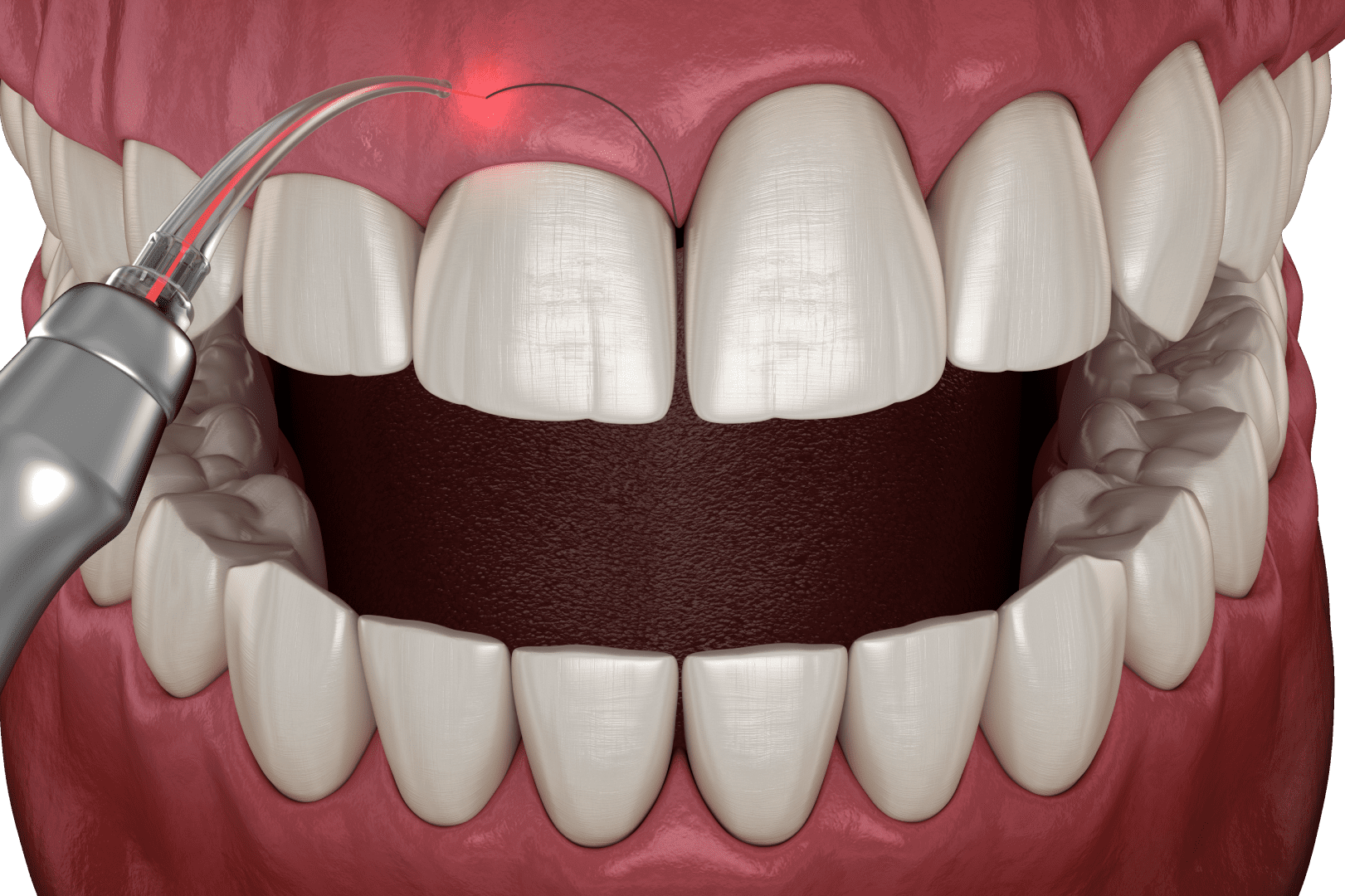 Підготовка до операції