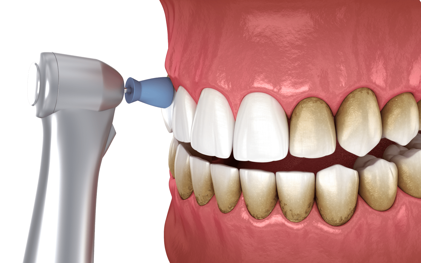 Професійне чищення