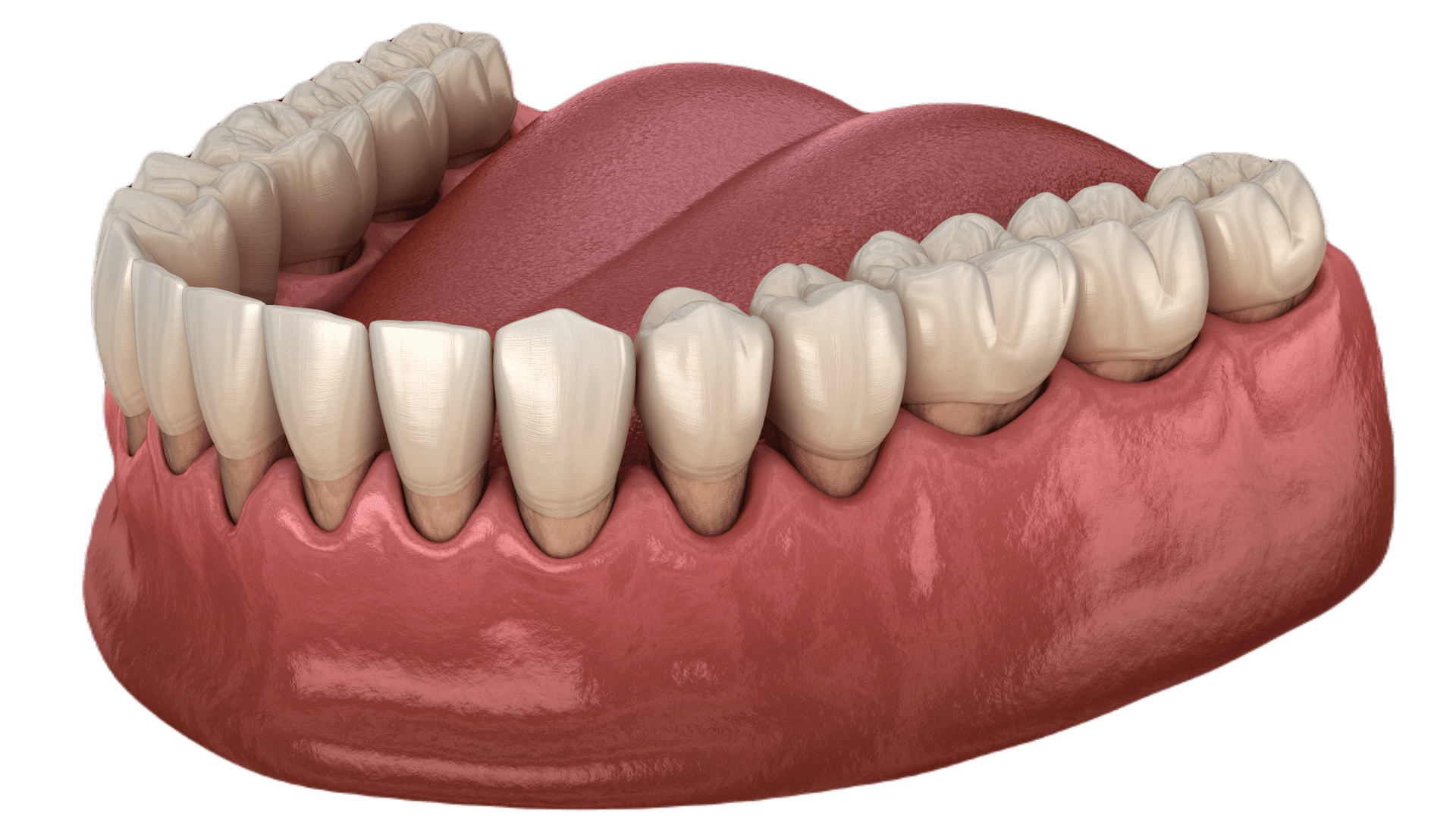Середня стадія рецесії