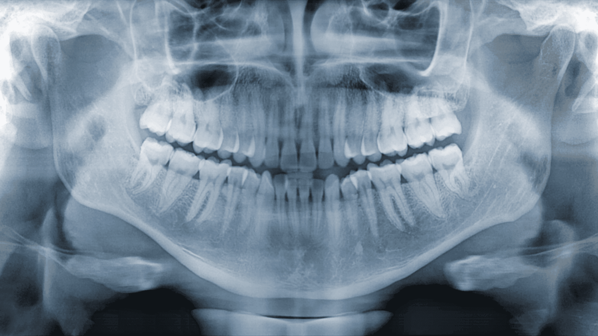 Рентген-діагностика