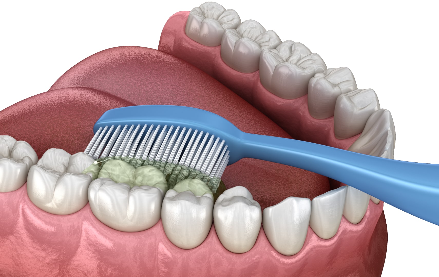 Чистка зубів