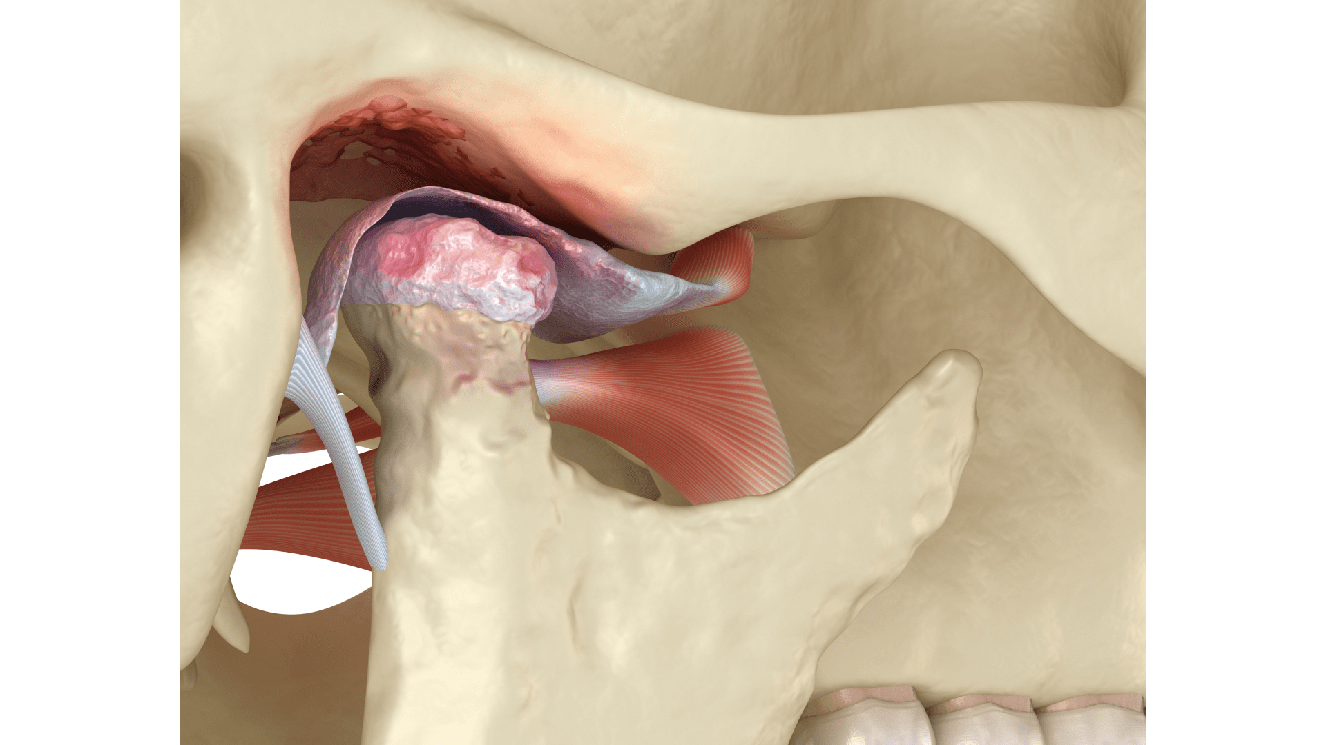 Скронево-нижньощелепний суглоб