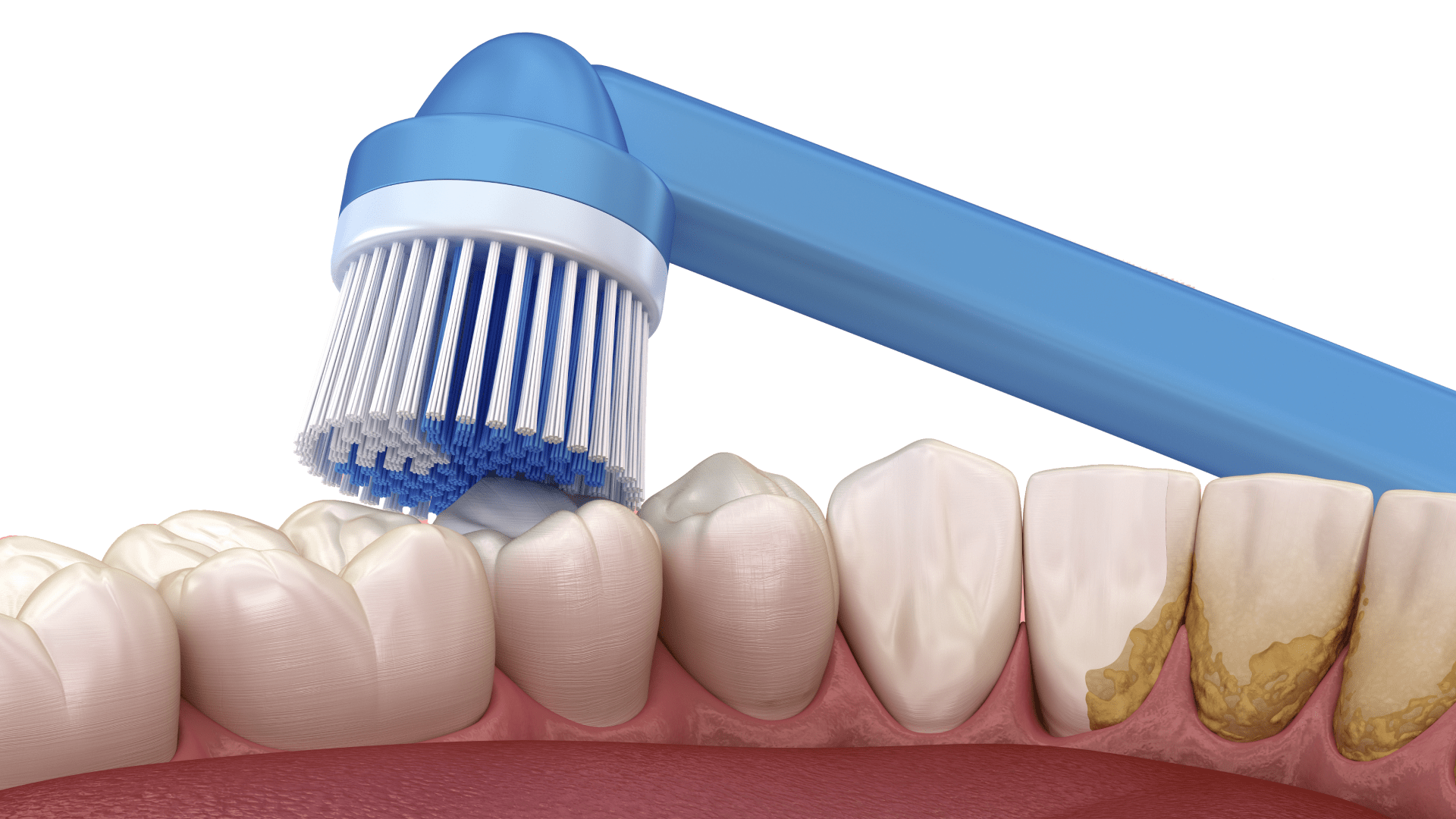 чистити зуби електричною щіткою